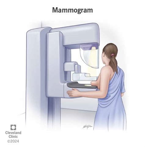 what is a mammogram exam